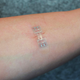 Image: KitoTech Medical